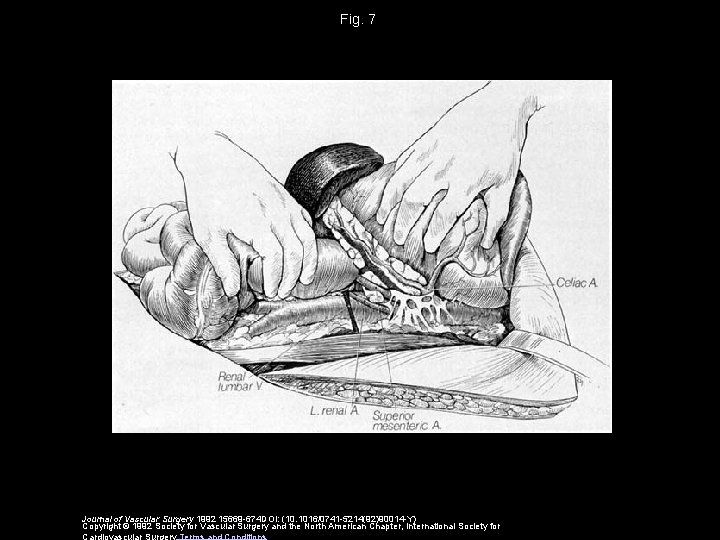 Fig. 7 Journal of Vascular Surgery 1992 15669 -674 DOI: (10. 1016/0741 -5214(92)90014 -Y)