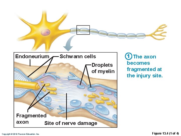 Endoneurium Schwann cells Droplets of myelin 1 The axon becomes fragmented at the injury