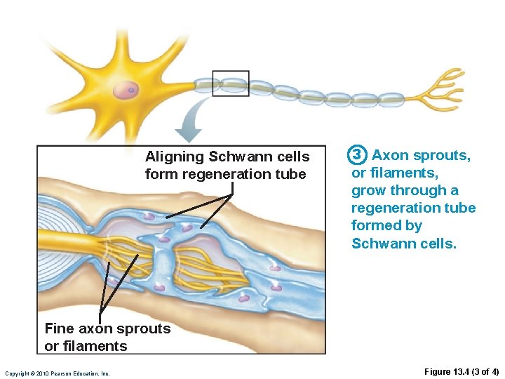 Aligning Schwann cells form regeneration tube 3 Axon sprouts, or filaments, grow through a