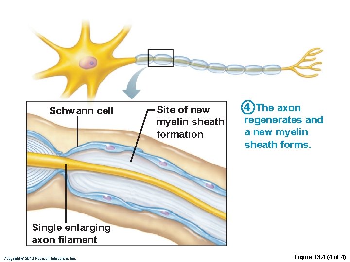 Schwann cell Site of new myelin sheath formation 4 The axon regenerates and a