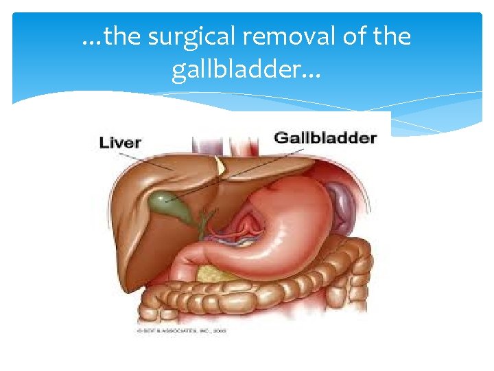 . . . the surgical removal of the gallbladder. . . 