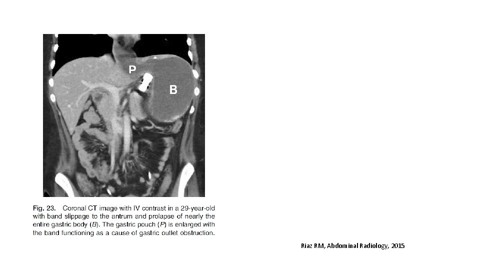 Riaz RM, Abdominal Radiology, 2015 