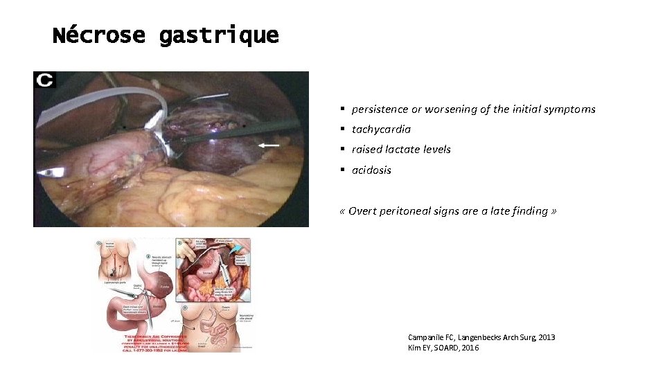 Nécrose gastrique § persistence or worsening of the initial symptoms § tachycardia § raised