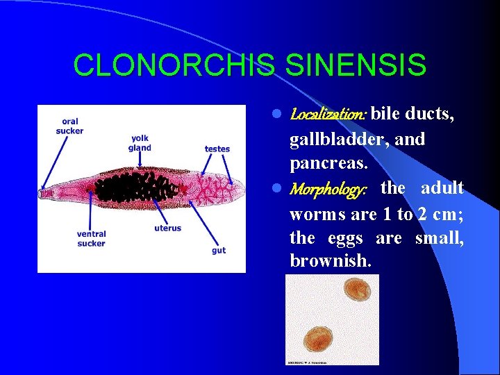 CLONORCHIS SINENSIS l Localization: bile ducts, gallbladder, and pancreas. l Morphology: the adult worms