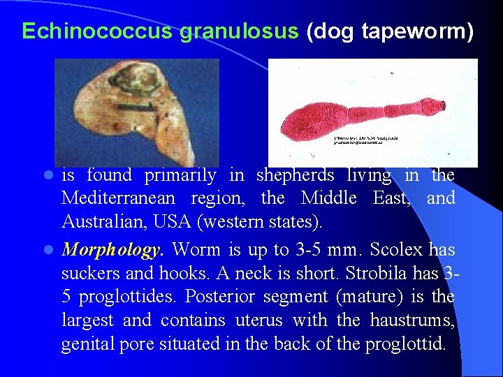 Echinococcus granulosus (dog tapeworm) is found primarily in shepherds living in the Mediterranean region,