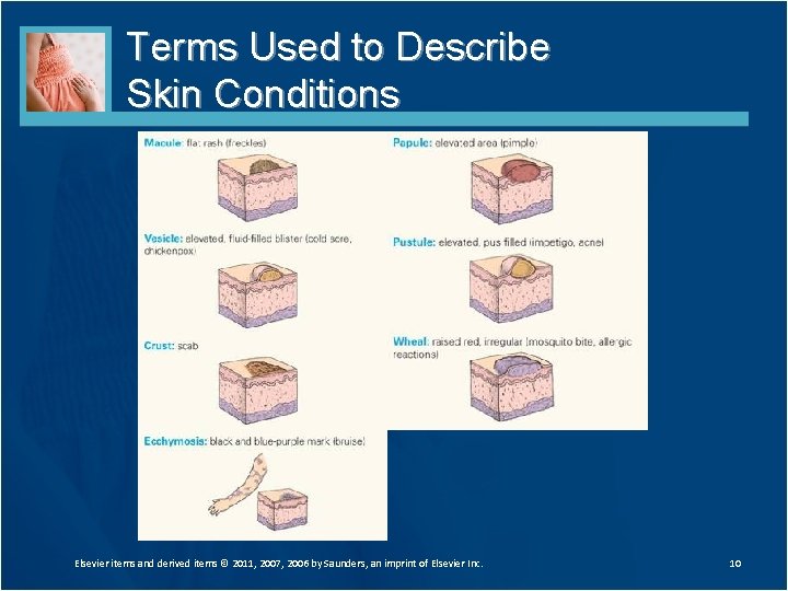 Terms Used to Describe Skin Conditions Elsevier items and derived items © 2011, 2007,