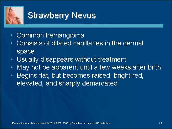 Strawberry Nevus • Common hemangioma • Consists of dilated capillaries in the dermal space