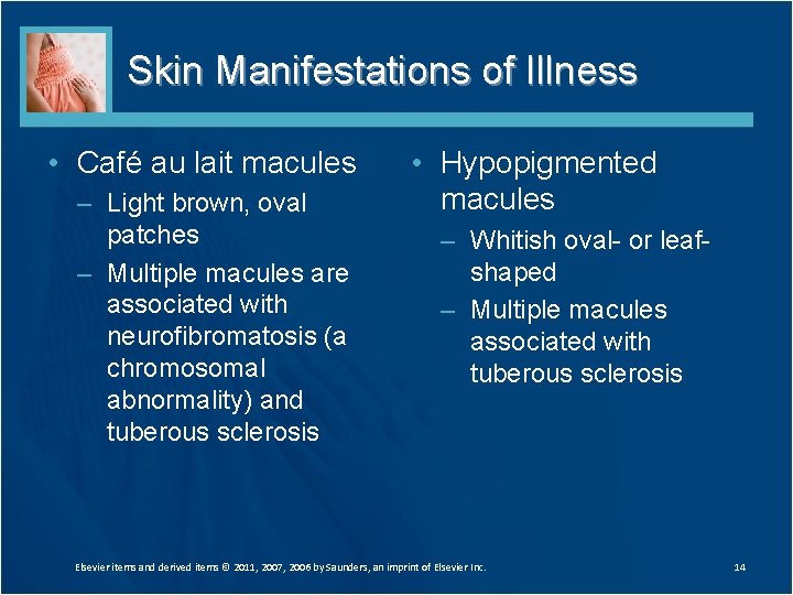 Skin Manifestations of Illness • Café au lait macules – Light brown, oval patches