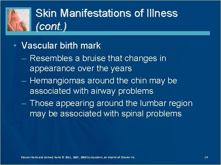 Skin Manifestations of Illness (cont. ) • Vascular birth mark – Resembles a bruise