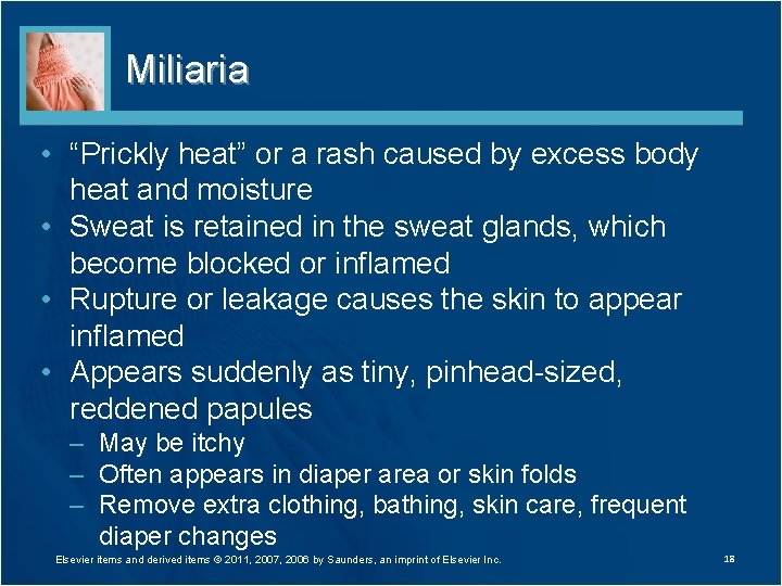 Miliaria • “Prickly heat” or a rash caused by excess body heat and moisture
