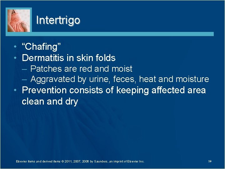 Intertrigo • “Chafing” • Dermatitis in skin folds – Patches are red and moist