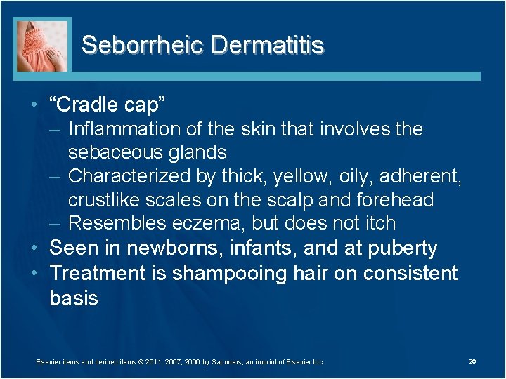 Seborrheic Dermatitis • “Cradle cap” – Inflammation of the skin that involves the sebaceous