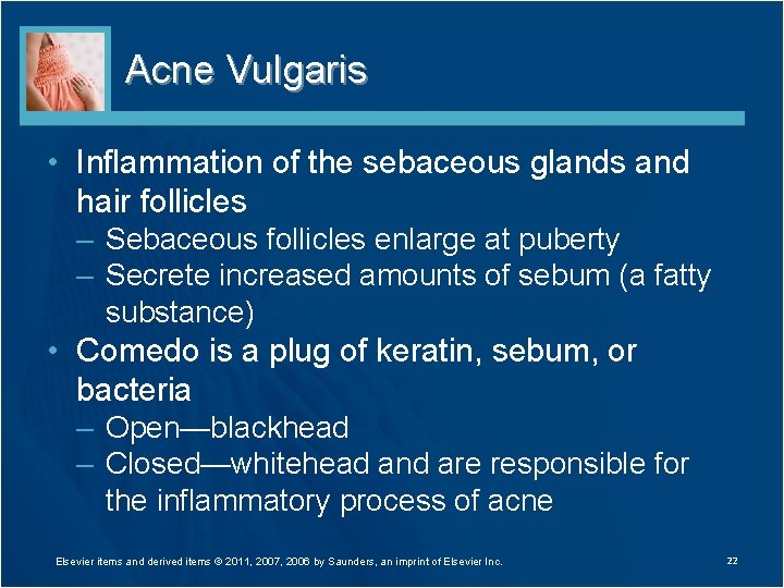 Acne Vulgaris • Inflammation of the sebaceous glands and hair follicles – Sebaceous follicles