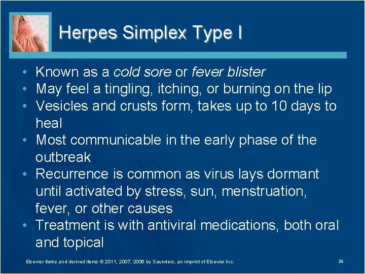 Herpes Simplex Type I • Known as a cold sore or fever blister •