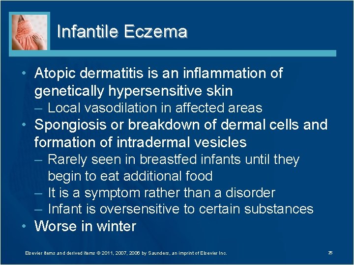 Infantile Eczema • Atopic dermatitis is an inflammation of genetically hypersensitive skin – Local