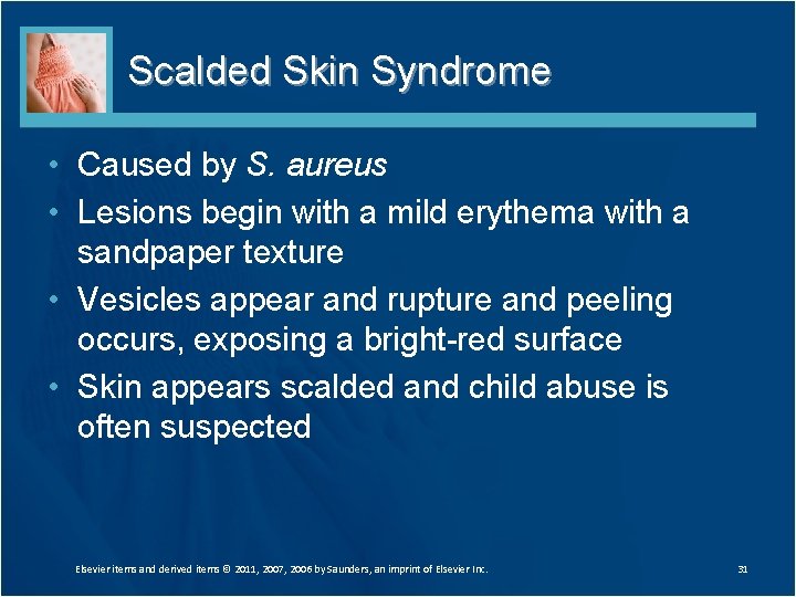 Scalded Skin Syndrome • Caused by S. aureus • Lesions begin with a mild