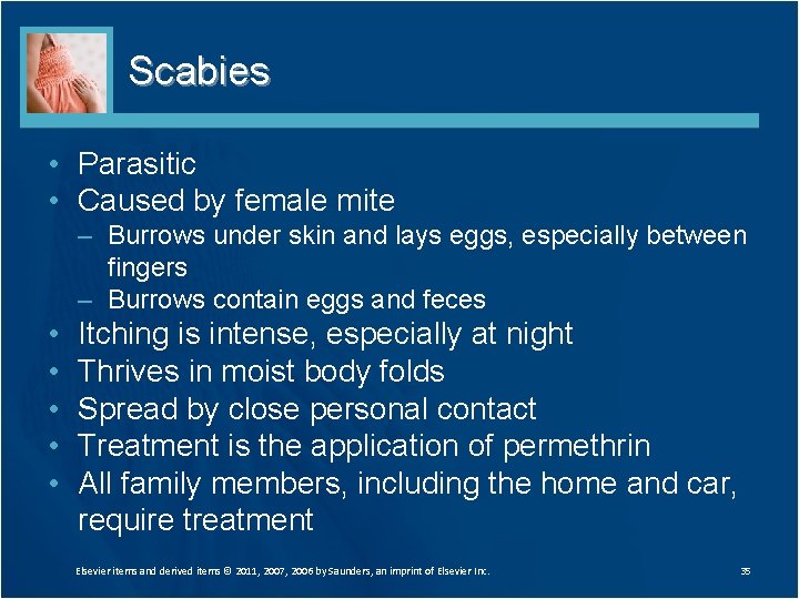 Scabies • Parasitic • Caused by female mite – Burrows under skin and lays