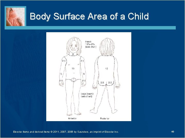 Body Surface Area of a Child Elsevier items and derived items © 2011, 2007,