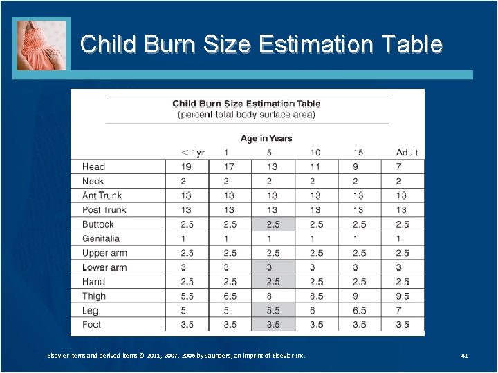 Child Burn Size Estimation Table Elsevier items and derived items © 2011, 2007, 2006