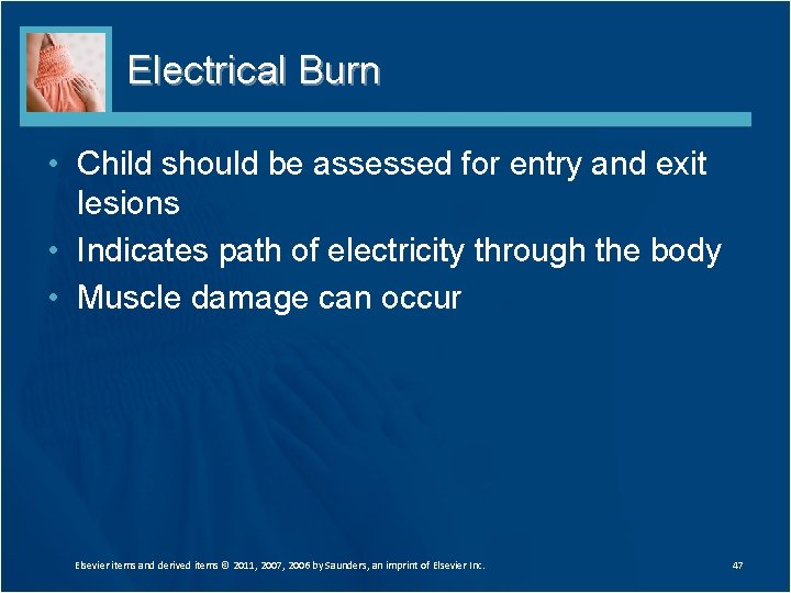 Electrical Burn • Child should be assessed for entry and exit lesions • Indicates