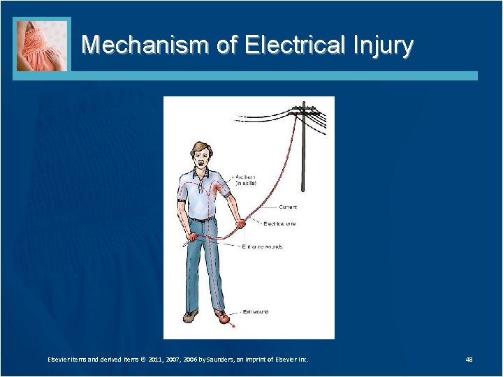 Mechanism of Electrical Injury Elsevier items and derived items © 2011, 2007, 2006 by