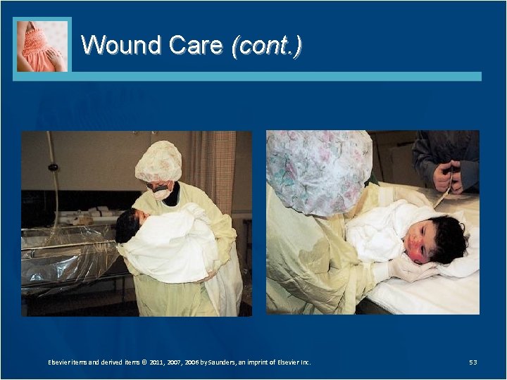 Wound Care (cont. ) Elsevier items and derived items © 2011, 2007, 2006 by