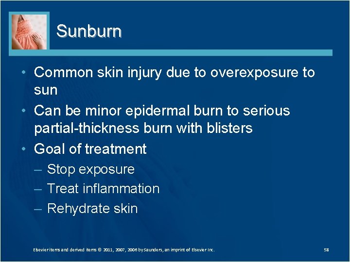 Sunburn • Common skin injury due to overexposure to sun • Can be minor