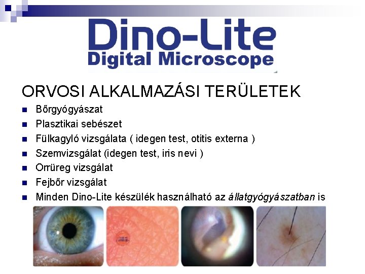 megvilágítás a szemvizsgálaton a deuteranopia a látásról szól