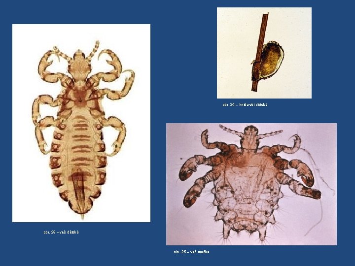 obr. 24 – hnida vši dětské obr. 23 – veš dětská obr. 25 –