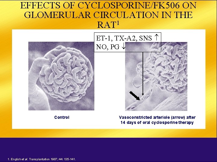 EFFECTS OF CYCLOSPORINE/FK 506 ON GLOMERULAR CIRCULATION IN THE RAT 1 ET-1, TX-A 2,