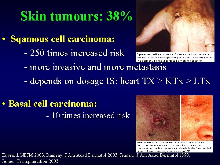 Skin tumours: 38% • Sqamous cell carcinoma: - 250 times increased risk - more