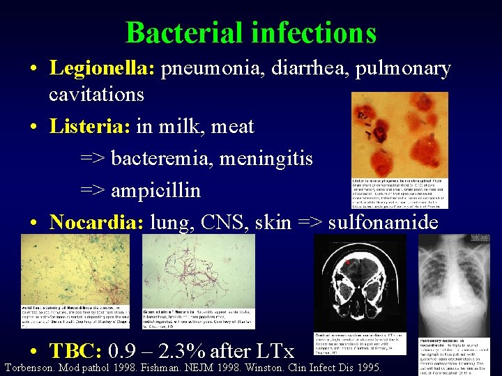 Bacterial infections • Legionella: pneumonia, diarrhea, pulmonary cavitations • Listeria: in milk, meat =>