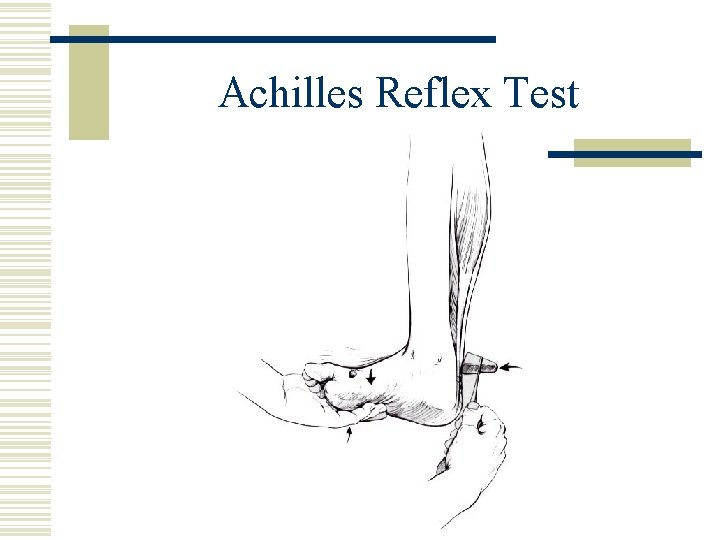 Achilles Reflex Test 