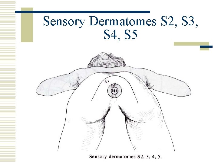 Sensory Dermatomes S 2, S 3, S 4, S 5 