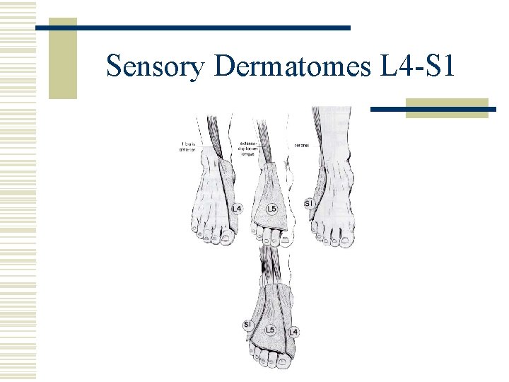 Sensory Dermatomes L 4 -S 1 