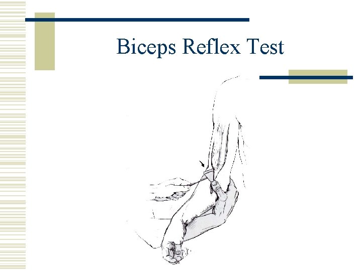 Biceps Reflex Test 