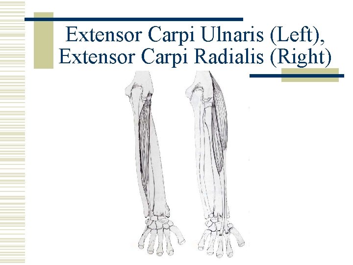 Extensor Carpi Ulnaris (Left), Extensor Carpi Radialis (Right) 