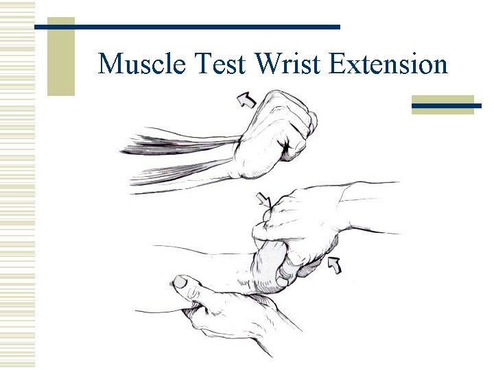 Muscle Test Wrist Extension 