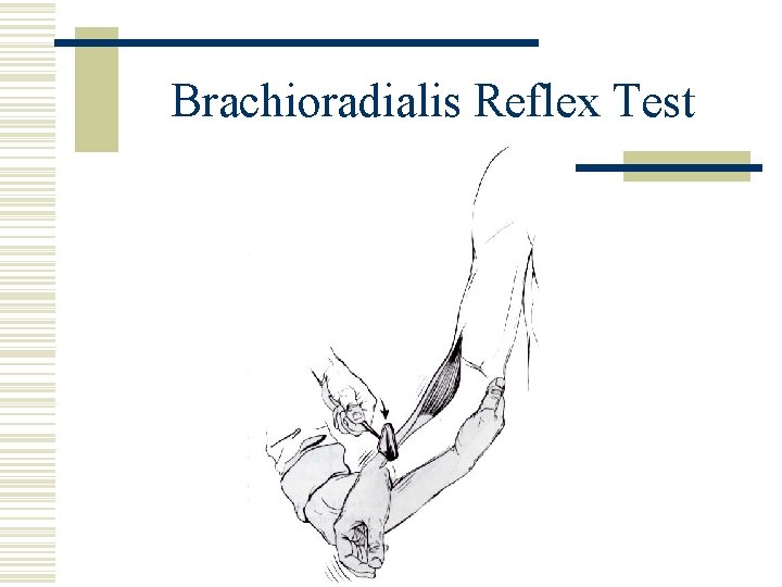 Brachioradialis Reflex Test 