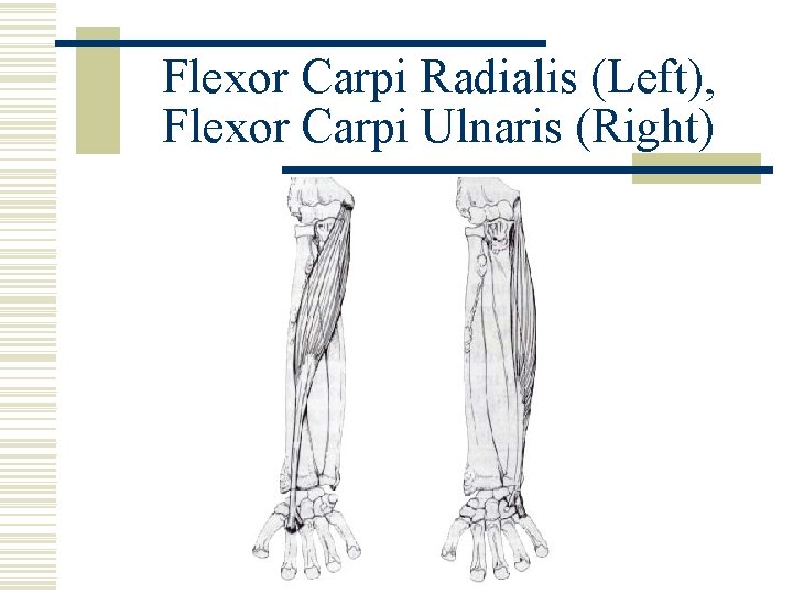 Flexor Carpi Radialis (Left), Flexor Carpi Ulnaris (Right) 