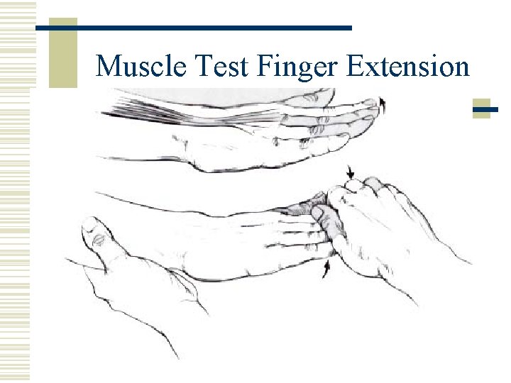 Muscle Test Finger Extension 