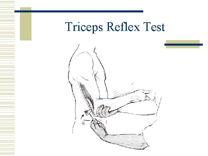 Triceps Reflex Test 