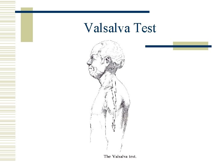 Valsalva Test 