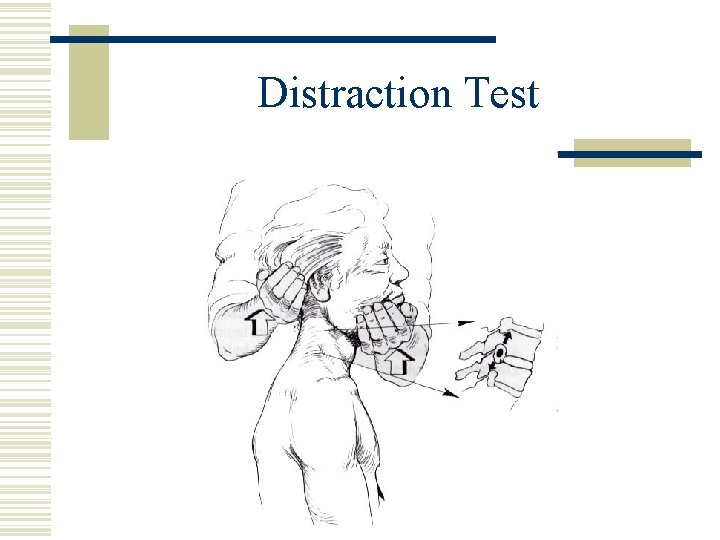 Distraction Test 