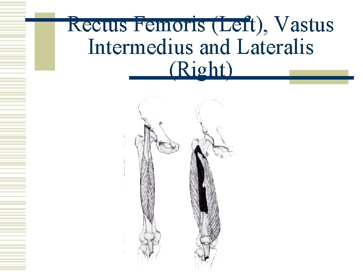 Rectus Femoris (Left), Vastus Intermedius and Lateralis (Right) 