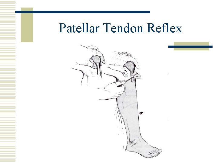 Patellar Tendon Reflex 