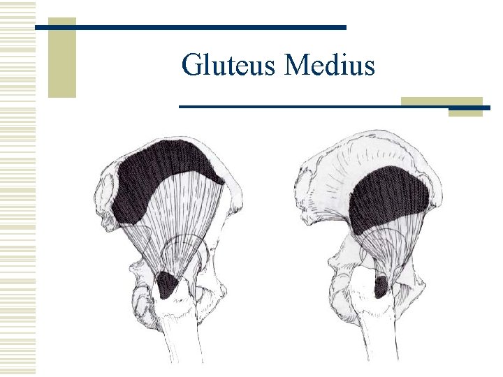 Gluteus Medius 