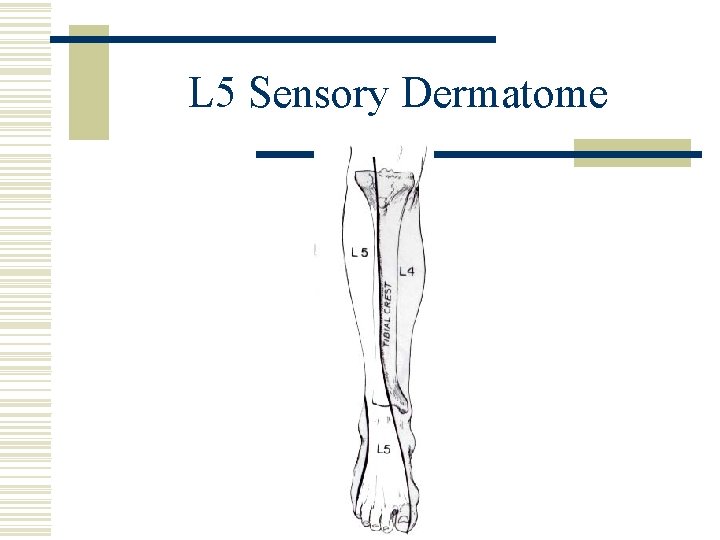 L 5 Sensory Dermatome 