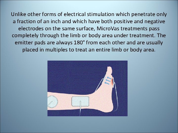 Unlike other forms of electrical stimulation which penetrate only a fraction of an inch Unlike other forms of electrical stimulation which penetrate only a fraction of an inch
