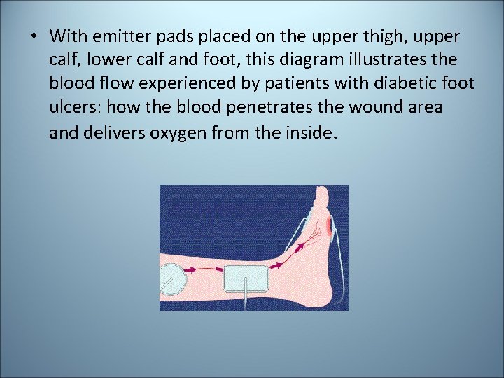 • With emitter pads placed on the upper thigh, upper calf, lower calf • With emitter pads placed on the upper thigh, upper calf, lower calf